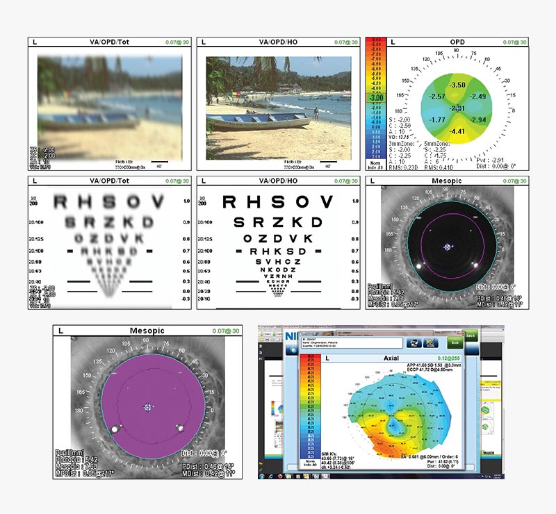 Marco OPD-Scan 3 Wavefront Aberrometer Refraction System