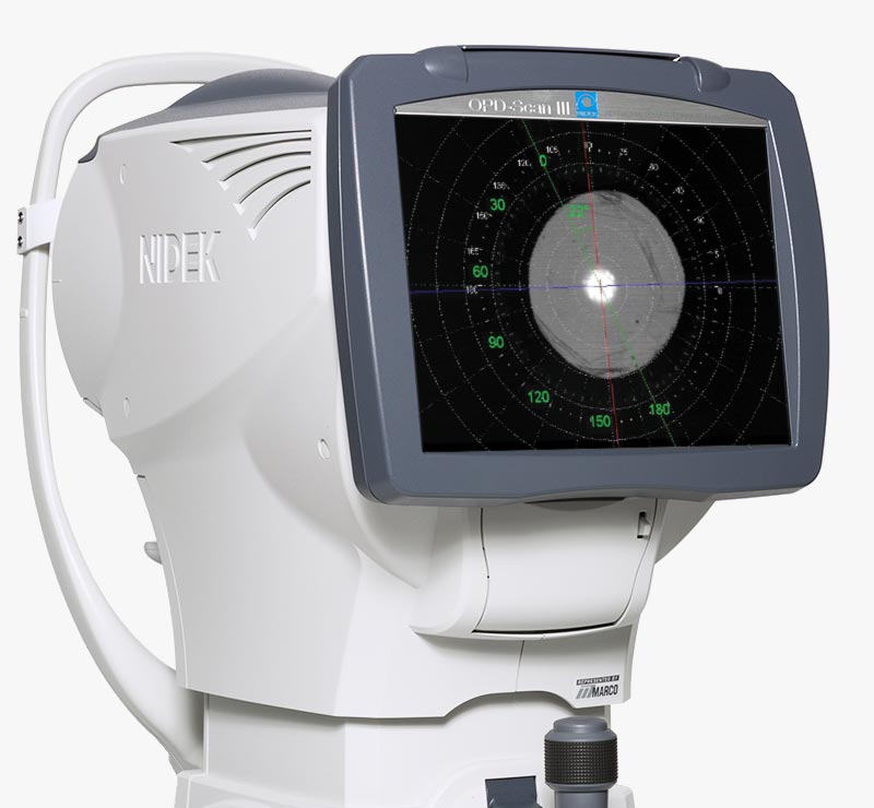 Marco OPD-Scan III Dysfunctional Lens Syndrome (DLS)