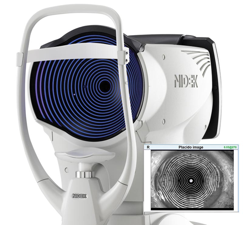 Marco OPD-Scan III Wavefront Aberrometer Refractions