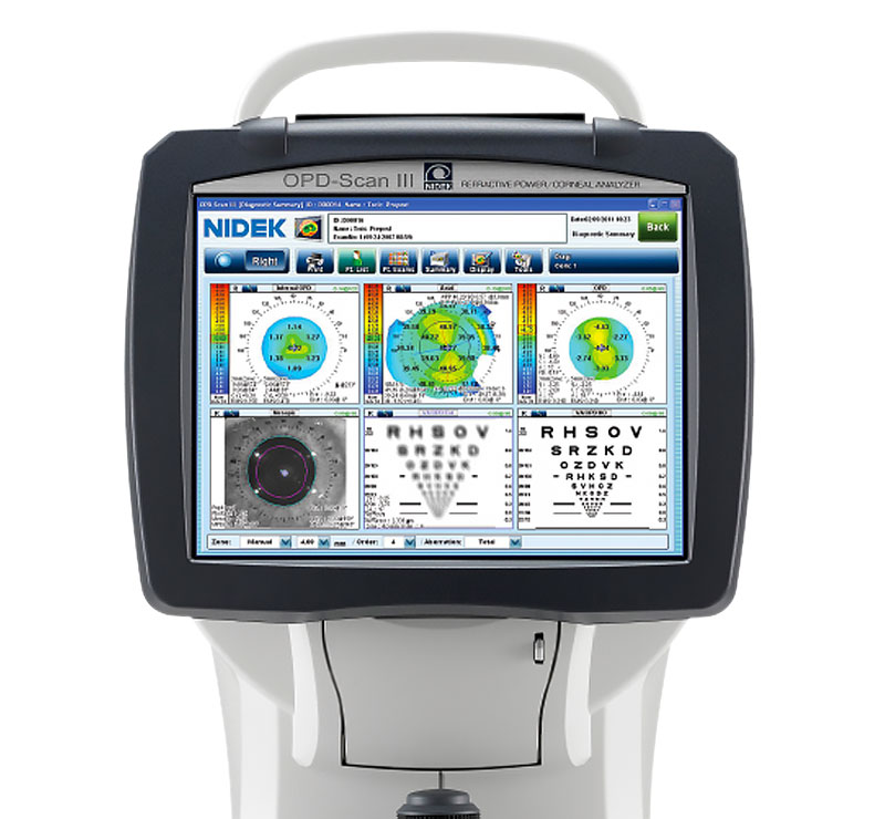 Marco OPD-Scan III Wavefront Aberrometer Refractions