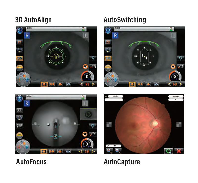 Marco AFC-330 Retinal Imaging System Auto Alignment