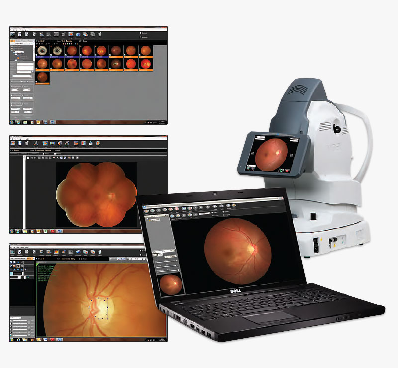 Marco AFC-330 Retinal Imaging System Data Management Flexibility