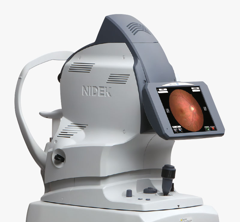 Marco AFC-330 Retinal Imaging System Advanced Features