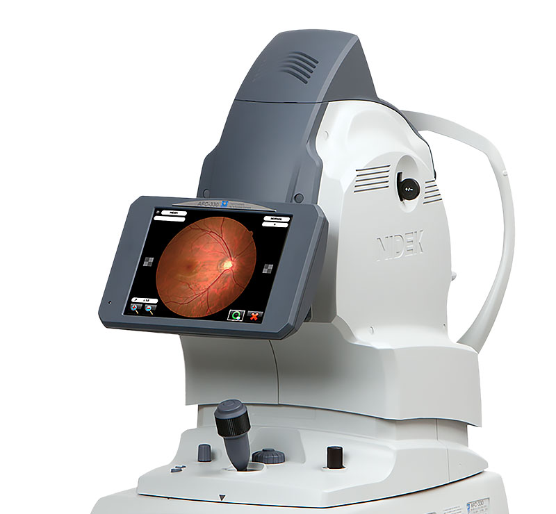 Marco AFC-330 Retinal Imaging System Modern Design