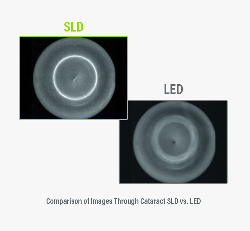 Marco M3 ARK SLD vs. LED Technology 