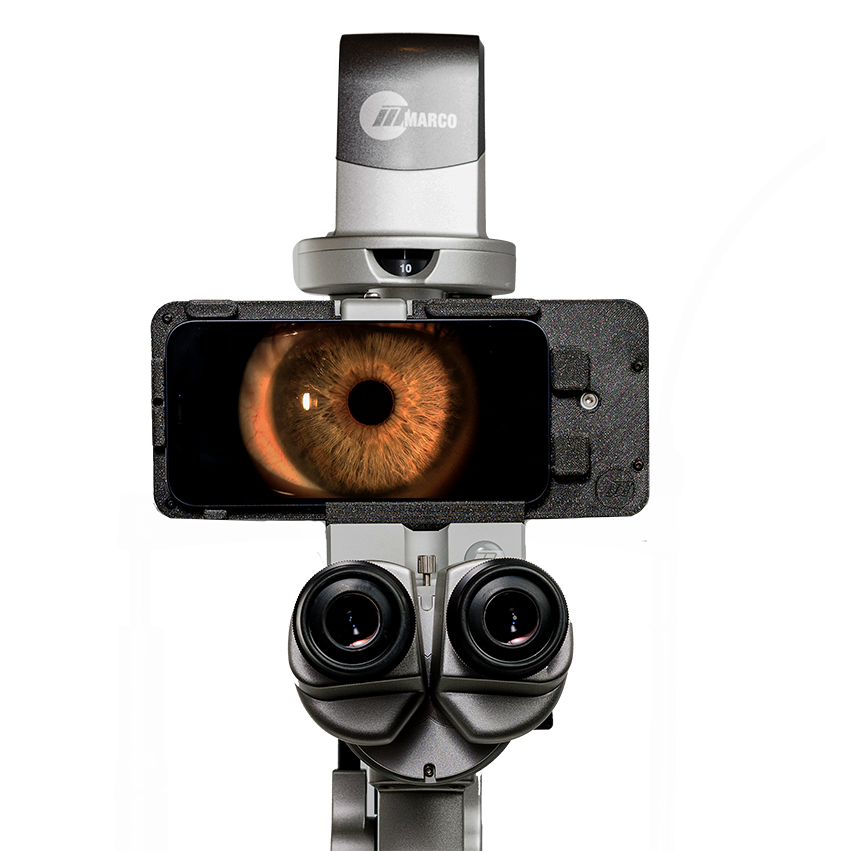 Marco Ion Slit Lamp Imaging System