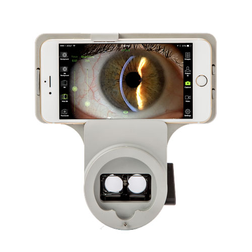The Marco iON Imaging System Intuitive, Optimized, and Networked
