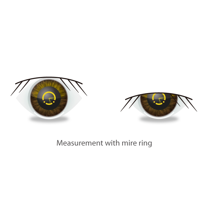 Marco ARK-1S Autorefractor & Keratometer Eye Tracking System