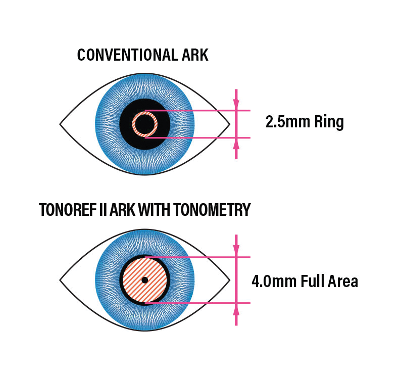Marco M3 ARK Non Contact Tonometer Small Pupil Zone Measurement