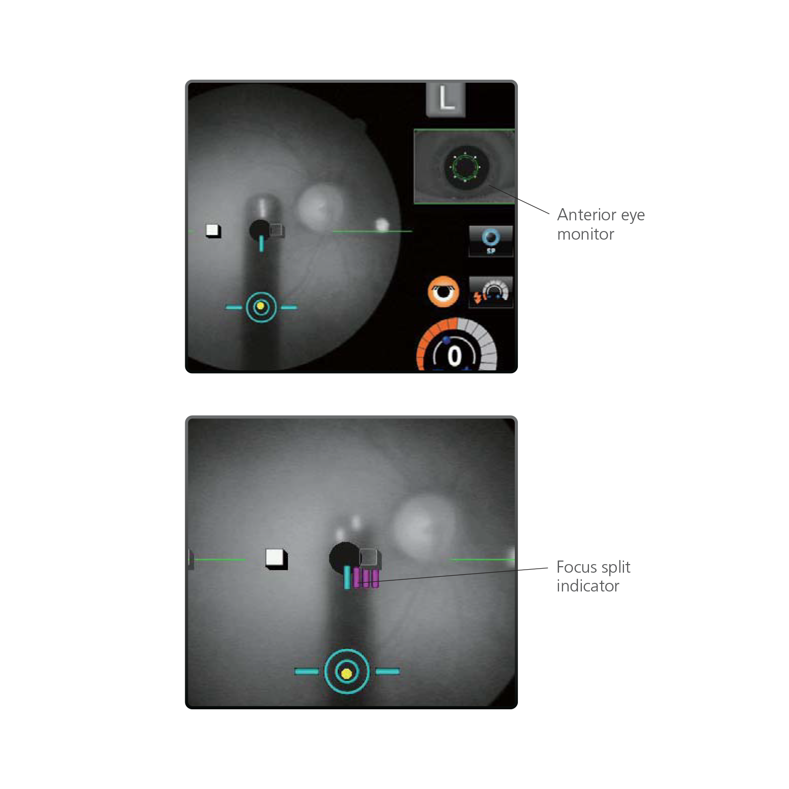 Marco AFC-330 Retinal Imaging System Patient Comfort