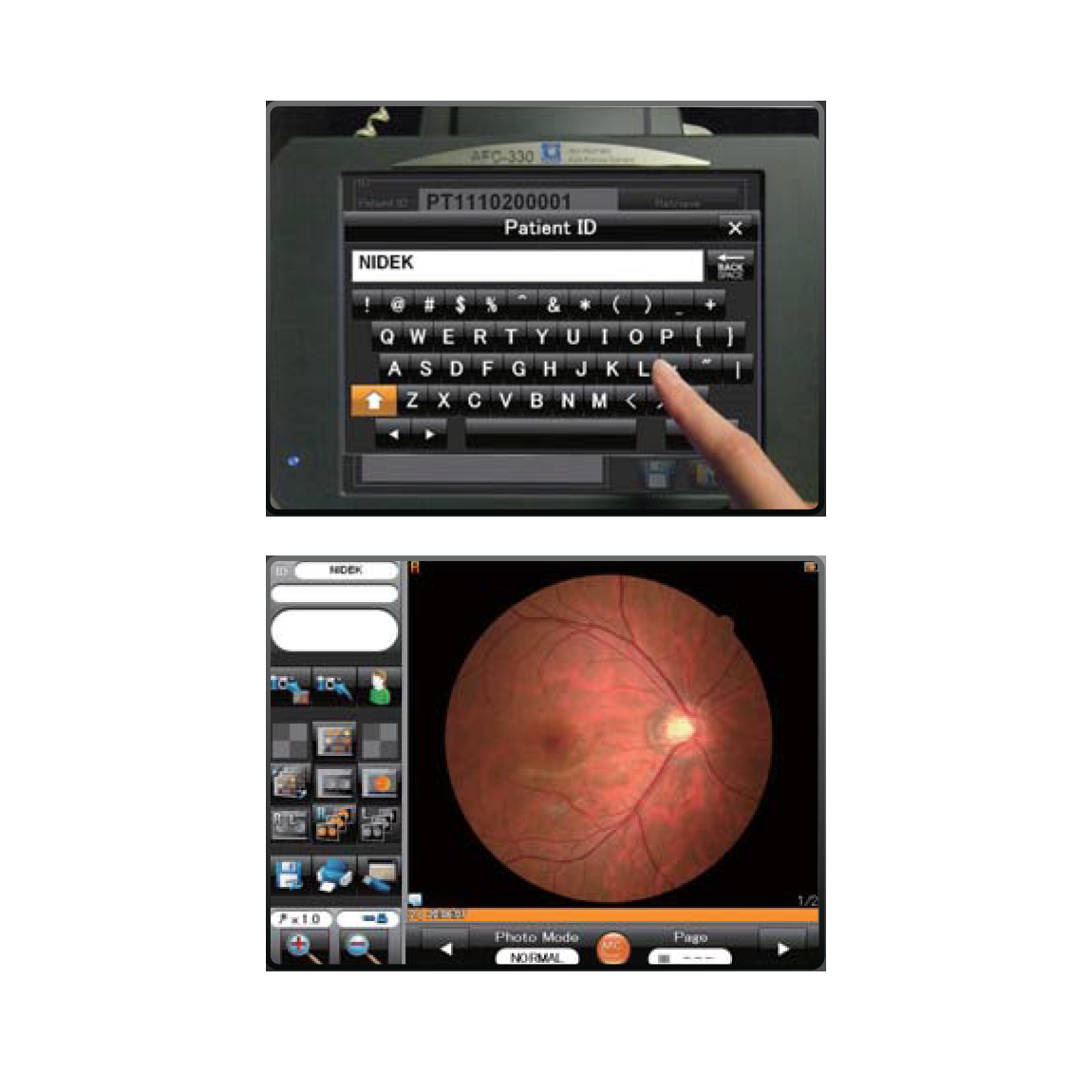 Marco AFC-330 Retinal Imaging System Patient Comfort